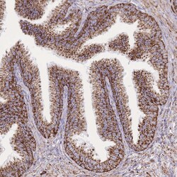 Invitrogen GSTM1 Polyclonal Antibody 100 μL; Unconjugated:Antibodies,