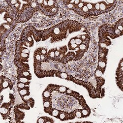 Invitrogen GSTM1 Polyclonal Antibody 100 μL; Unconjugated:Antibodies,