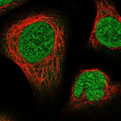 Invitrogen NUP214 Polyclonal Antibody 100 &mu;L; Unconjugated:Antibodies,