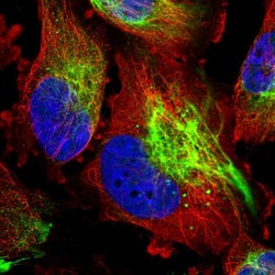 Invitrogen TRPML2 Polyclonal Antibody 100 μL; Unconjugated:Antibodies,