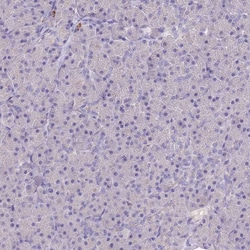 Invitrogen P2Y13 Polyclonal Antibody 100 &mu;L; Unconjugated:Antibodies,