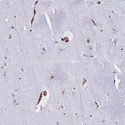 EML1 Polyclonal Antibody, Invitrogen 100 &mu;L; Unconjugated:Antibodies,