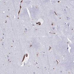 Invitrogen EML1 Polyclonal Antibody 100 &mu;L; Unconjugated:Antibodies,