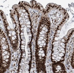 Invitrogen KLF3 Polyclonal Antibody 100 &mu;L; Unconjugated:Antibodies,