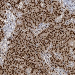 Invitrogen KLF3 Polyclonal Antibody 100 &mu;L; Unconjugated:Antibodies,