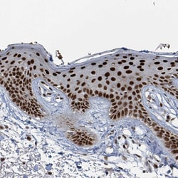 Invitrogen KLF3 Polyclonal Antibody 100 &mu;L; Unconjugated:Antibodies,