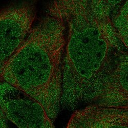 PUM2 Polyclonal Antibody:Antibodies, Polyclonal