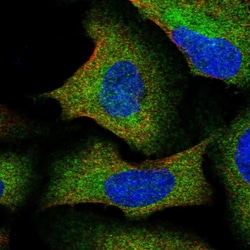 Invitrogen IKAP Polyclonal Antibody 100 &mu;L; Unconjugated:Antibodies,