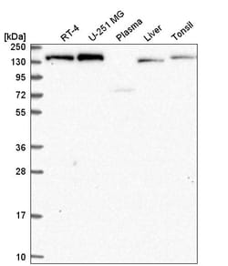 Invitrogen IKAP Polyclonal Antibody 100 &mu;L; Unconjugated:Antibodies,