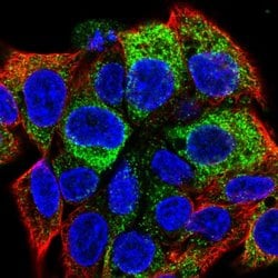 Apolipoprotein B Polyclonal Antibody, Invitrogen 100 &mu;L; Unconjugated:Antibodies,