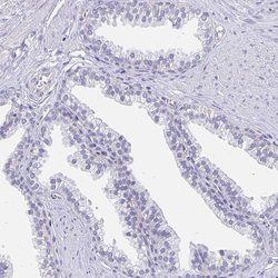 Apolipoprotein B Polyclonal Antibody, Invitrogen 100 &mu;L; Unconjugated:Antibodies,