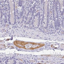 Apolipoprotein B Polyclonal Antibody, Invitrogen 100 &mu;L; Unconjugated:Antibodies,