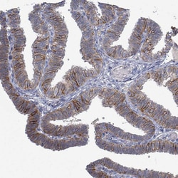 Invitrogen K-Ras Polyclonal Antibody 100 μL; Unconjugated:Antibodies,
