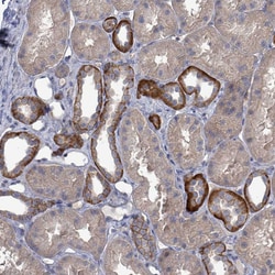 Invitrogen K-Ras Polyclonal Antibody 100 μL; Unconjugated:Antibodies,