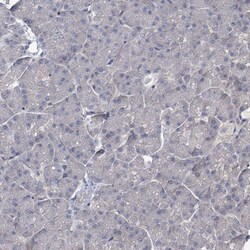 Invitrogen K-Ras Polyclonal Antibody 100 μL; Unconjugated:Antibodies,