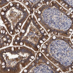 Invitrogen K-Ras Polyclonal Antibody 100 μL; Unconjugated:Antibodies,