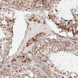 Invitrogen MAVS Polyclonal Antibody 100 &mu;L; Unconjugated:Antibodies,