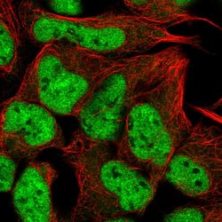 RUNX1T1 Polyclonal Antibody, Invitrogen 100 &mu;L; Unconjugated:Antibodies,