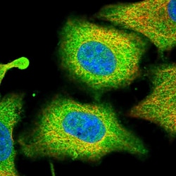 Invitrogen PLA2G4A Polyclonal Antibody:Antibodies:Primary Antibodies