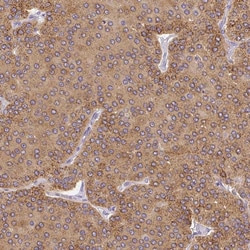 Invitrogen PLA2G4A Polyclonal Antibody:Antibodies:Primary Antibodies