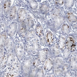 Invitrogen WNT11 Polyclonal Antibody 100 &mu;L | Buy Online | Invitrogen&trade; | Fisher Scientific