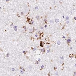 Invitrogen HLA-DRA Polyclonal Antibody 100 &mu;L; Unconjugated:Antibodies,