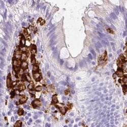 Invitrogen HLA-DRA Polyclonal Antibody 100 &mu;L; Unconjugated:Antibodies,
