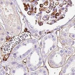 Invitrogen HLA-DRA Polyclonal Antibody 100 &mu;L; Unconjugated:Antibodies,