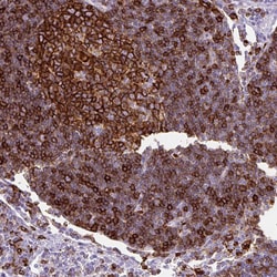 Invitrogen HLA-DRA Polyclonal Antibody 100 &mu;L; Unconjugated:Antibodies,