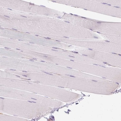 Invitrogen HLA-DRA Polyclonal Antibody 100 &mu;L; Unconjugated:Antibodies,