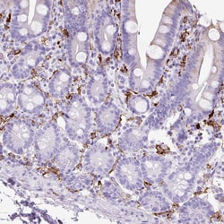 Invitrogen HLA-DRA Polyclonal Antibody 100 &mu;L; Unconjugated:Antibodies,