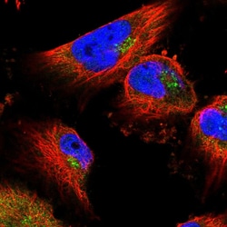 Invitrogen USP8 Polyclonal Antibody 100 μL; Unconjugated:Antibodies,