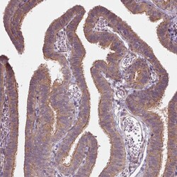 Invitrogen USP8 Polyclonal Antibody 100 μL; Unconjugated:Antibodies,