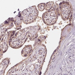 Invitrogen USP8 Polyclonal Antibody 100 μL; Unconjugated:Antibodies,