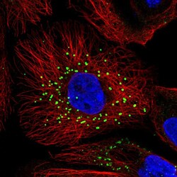 Invitrogen Jagged2 Polyclonal Antibody 100 μL; Unconjugated:Antibodies,
