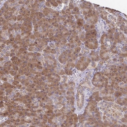Invitrogen IKAP Polyclonal Antibody 100 &mu;L; Unconjugated:Antibodies,