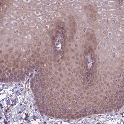 Invitrogen ITPKC Polyclonal Antibody 100 &mu;L; Unconjugated:Antibodies,
