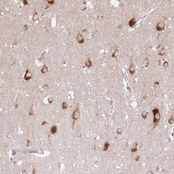 Invitrogen ATP13A2 Polyclonal Antibody 100 &mu;L; Unconjugated:Antibodies,