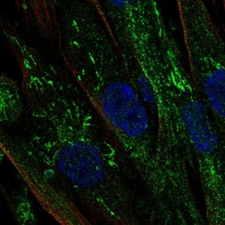 Invitrogen Aromatase Polyclonal Antibody 100 μL; Unconjugated:Antibodies,