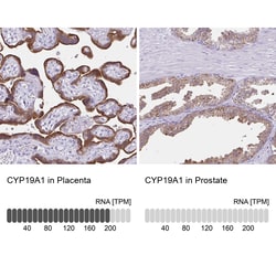 Invitrogen Aromatase Polyclonal Antibody 100 μL; Unconjugated:Antibodies,
