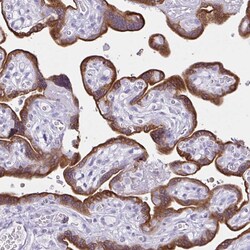 Invitrogen Aromatase Polyclonal Antibody 100 μL; Unconjugated:Antibodies,