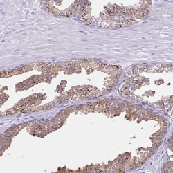 Invitrogen Aromatase Polyclonal Antibody 100 μL; Unconjugated:Antibodies,