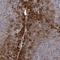 Invitrogen TRPC4AP Polyclonal Antibody 100 &mu;L; Unconjugated:Antibodies,