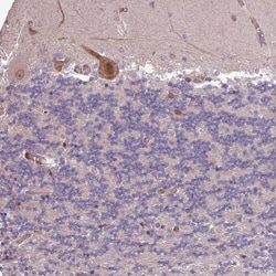 Invitrogen CABP1 Polyclonal Antibody 100 &mu;L; Unconjugated:Antibodies,