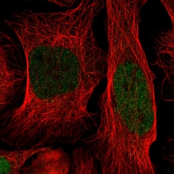 Invitrogen ID1 Polyclonal Antibody 100 &mu;L; Unconjugated:Antibodies,