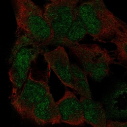 Invitrogen ZFP82 Polyclonal Antibody 100 μL; Unconjugated:Antibodies,