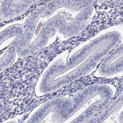 Invitrogen Kallikrein 4 Polyclonal Antibody 100 &mu;L; Unconjugated:Antibodies,