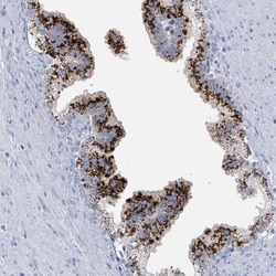 Invitrogen Kallikrein 4 Polyclonal Antibody 100 &mu;L; Unconjugated:Antibodies,