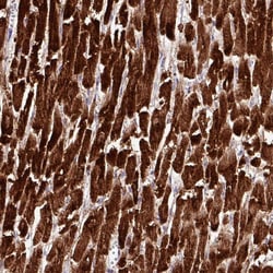 Invitrogen CKMT2 Polyclonal Antibody 100 μL; Unconjugated:Antibodies,