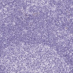 Invitrogen CKMT2 Polyclonal Antibody 100 μL; Unconjugated:Antibodies,